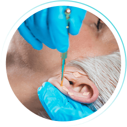 Curso de Auriculoterapia (WebHoje)