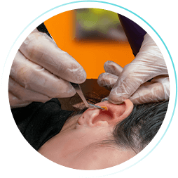 Curso de Auriculoterapia (WebHoje)