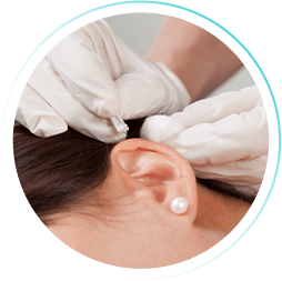 Curso de Auriculoterapia (WebHoje)