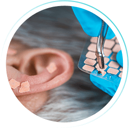 Curso de Auriculoterapia (WebHoje)