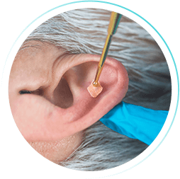 Curso de Auriculoterapia (WebHoje)